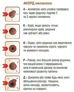 http://bogomoletsclinic.com.ua/_publication/51431260612_/akord_melanomy_.JPG